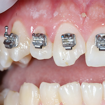 Стоматология Smile-territory в Саратове:  Современные технологии и забота о пациентах